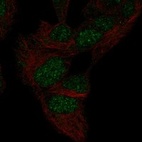 Anti-MXI1 Antibody