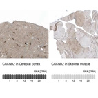 Anti-CACNB2 Antibody