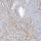 Immunohistochemical staining of human prostate shows weak to moderate membranous positivity in smooth muscle cells.