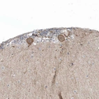 Immunohistochemical staining of human cerebellum shows moderate to strong membranous positivity in Purkinje cells.