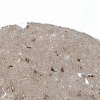 Immunohistochemical staining of human cerebral cortex shows moderate to strong membranous positivity in neurons.