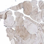 Immunohistochemical staining of human skeletal muscle shows very weak positivity in myocytes.