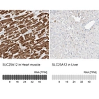 Anti-SLC25A12 Antibody