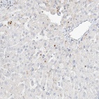 Anti-SLC25A12 Antibody
