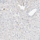 Immunohistochemical staining of human liver shows low expression as expected.