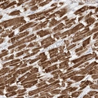 Immunohistochemical staining of human heart muscle shows high expression.