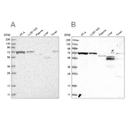 Western blot analysis using Anti-SLC25A12 antibody HPA035334 (A) shows similar pattern to independent antibody HPA035333 (B).