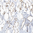 Anti-ECM2 Antibody