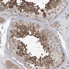 Anti-SOGA3 Antibody