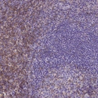 Immunohistochemical staining of human tonsil shows moderate membranous and cytoplasmic positivity, mainly in non - germinal center cells.