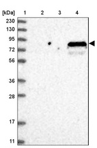 Lane 1: Marker [kDa] 230, 130, 95, 72, 56, 36, 28, 17, 11_br/_Lane 2: Human cell line RT-4_br/_Lane 3: Human cell line U-251MG sp_br/_Lane 4: Human plasma (IgG/HSA depleted)