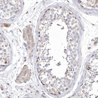 Immunohistochemical staining of human testis shows weak cytoplasmic positivity in Leydig cells.