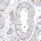 Immunohistochemical staining of human testis shows weak cytoplasmic positivity in Leydig cells.