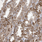 Immunohistochemical staining of human stomach shows strong cytoplasmic positivity in glandular cells.