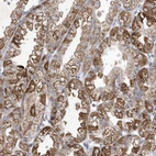 Immunohistochemical staining of human stomach shows strong cytoplasmic positivity in glandular cells.