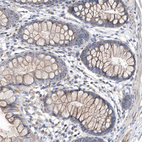 Immunohistochemical staining of human colon shows weak cytoplasmic positivity in glandular cells.