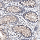 Immunohistochemical staining of human colon shows weak cytoplasmic positivity in glandular cells.