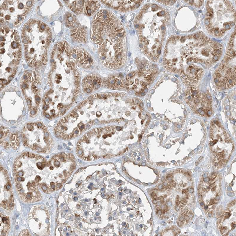 Anti-CERKL Antibody