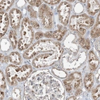 Anti-CERKL Antibody