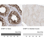 Anti-EHBP1 Antibody