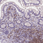 Anti-CD4 Antibody