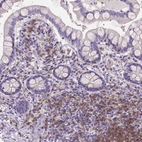 Immunohistochemical staining of human small intestine shows moderate membranous and cytoplasmic positivity in lymphoid cells.