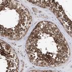 Immunohistochemical staining of human testis shows strong cytoplasmic positivity in cells in seminiferous ducts.