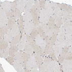 Immunohistochemical staining of human skeletal muscle shows negative to very weak cytoplasmic positivity in myocytes.