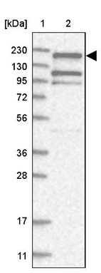 Lane 1: Marker [kDa] 230, 130, 95, 72, 56, 36, 28, 17, 11_br/_Lane 2: Human cell line RT-4