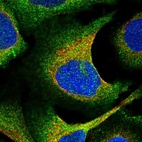 Immunofluorescent staining of human cell line U-2 OS shows localization to plasma membrane & cytosol.