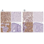 Immunohistochemical staining of human adrenal gland, cerebral cortex, kidney and skin using Anti-GALM antibody HPA035472 (A) shows similar protein distribution across tissues to independent antibody HPA035473 (B).
