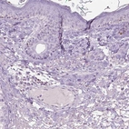 Immunohistochemical staining of human skin shows low expression as expected.