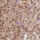 Immunohistochemical staining of human adrenal gland using Anti-GALM antibody HPA035472.