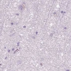 Immunohistochemical staining of human cerebral cortex using Anti-GALM antibody HPA035472.