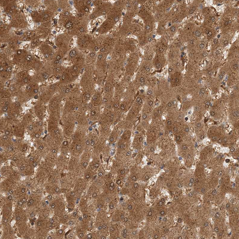 Anti-HNMT Antibody