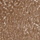 Anti-HNMT Antibody