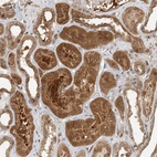 Immunohistochemical staining of human kidney shows strong cytoplasmic positivity in cells in tubules.