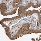 Immunohistochemical staining of human fallopian tube shows strong cytoplasmic positivity in glandular cells.
