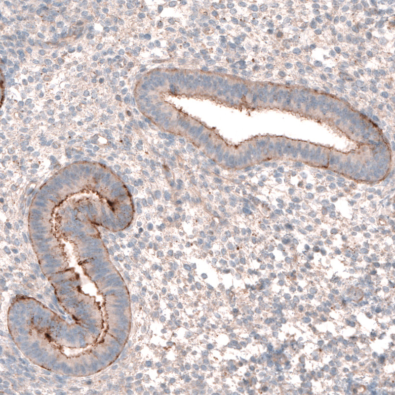 Anti-LRRC15 Antibody