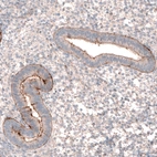 Anti-LRRC15 Antibody