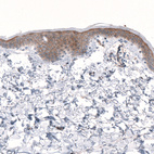 Immunohistochemical staining of human skin shows moderate membranous and weaker cytoplasmic positivity in epidermal cells.