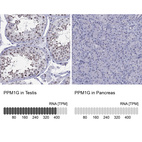 Anti-PPM1G Antibody