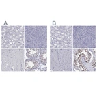 Immunohistochemical staining of human kidney, pancreas, skeletal muscle and testis using Anti-PPM1G antibody HPA035531 (A) shows similar protein distribution across tissues to independent antibody HPA035530 (B).