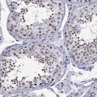Immunohistochemical staining of human testis shows strong nuclear positivity in cells in seminiferous ducts.