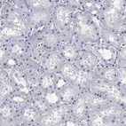 Immunohistochemical staining of human kidney shows no positivity in cells in tubules as expected.