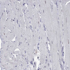 Immunohistochemical staining of human skeletal muscle shows no positivity in myocytes as expected..