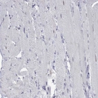 Immunohistochemical staining of human skeletal muscle shows no positivity in myocytes as expected..