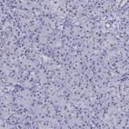 Immunohistochemical staining of human pancreas shows no positivity in exocrine glandular cells as expected..