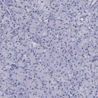 Immunohistochemical staining of human pancreas shows no positivity in exocrine glandular cells as expected..