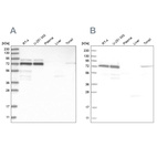 Western blot analysis using Anti-PPM1G antibody HPA035531 (A) shows similar pattern to independent antibody HPA035530 (B).